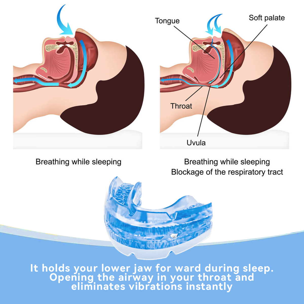 Adjustable Tooth Socket Night Anti-wear Screw Adjustment